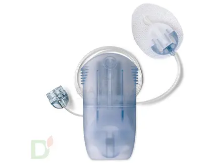 Инфузионный набор MIO30 / МИО30, 13/60см (MMT-905А), 1 шт.