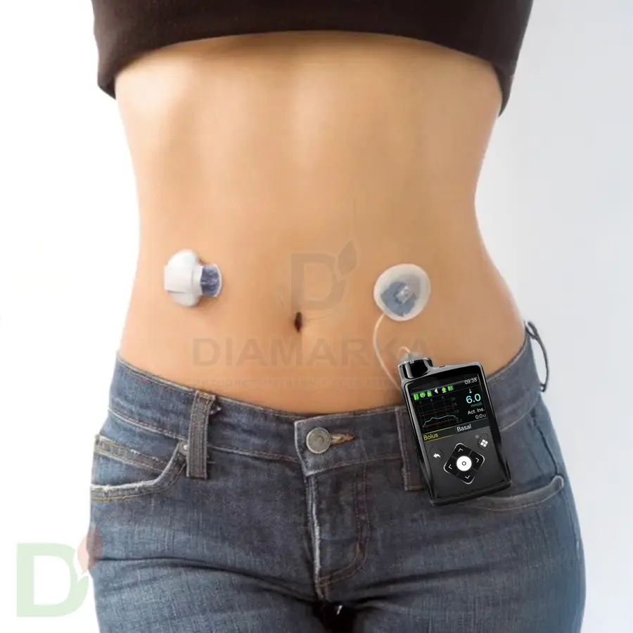 Инсулиновая помпа Medtronic MiniMed 740G с возможностью подключения смартфона, MMT-1861